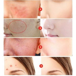 Aichun Beauty Olive With Collagen Whitening Mask - Image 3